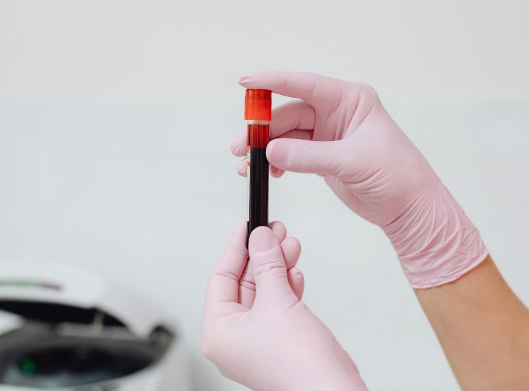 how-to-improve-a-low-white-blood-cell-count-causes-solutions-and-when-to-seek-help